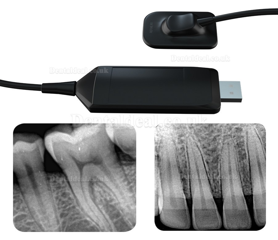 Refine Dental Intraoral X-ray Sensor DynImage Digital Intraoral Imaging System